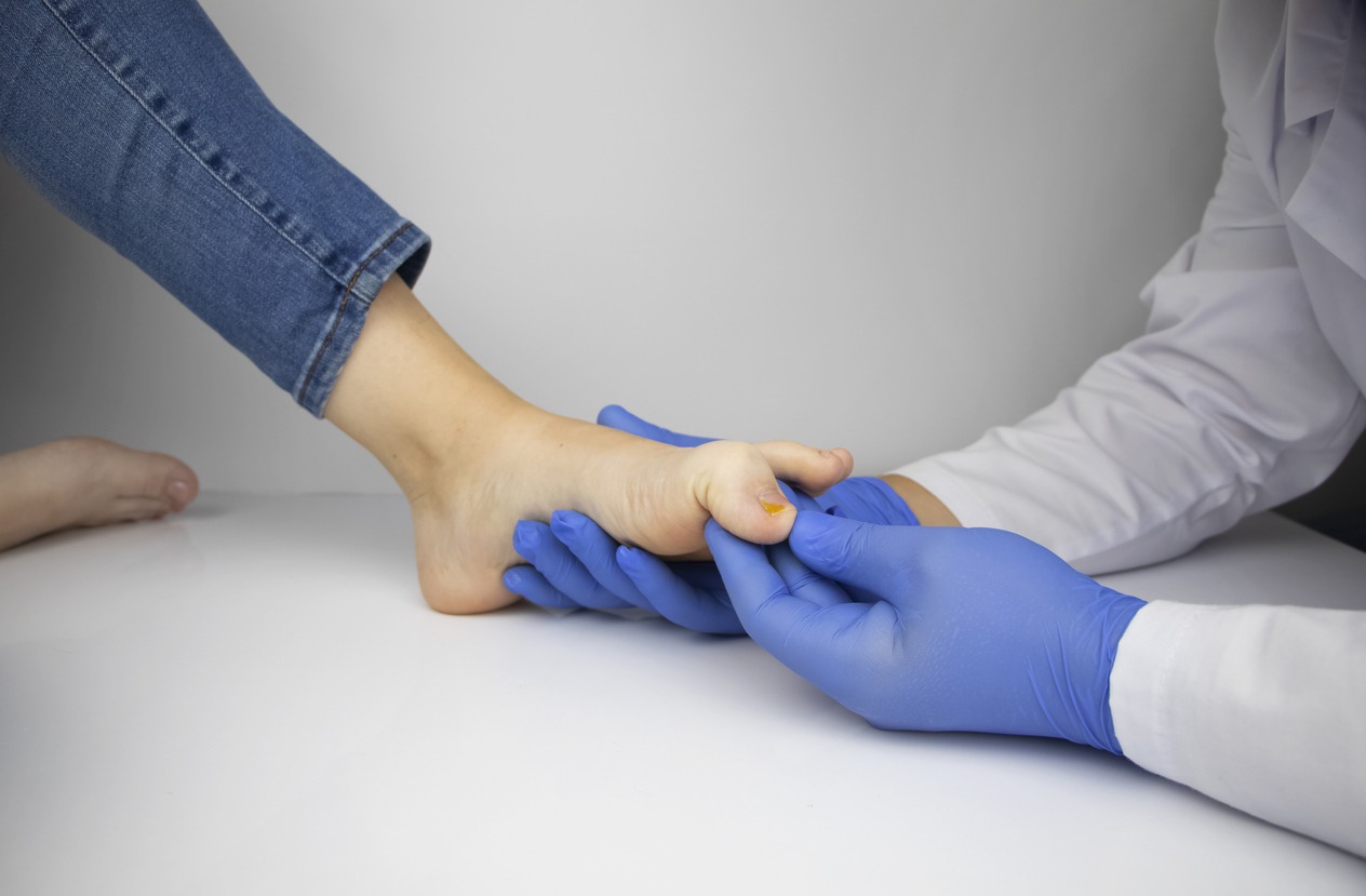 A dermatologist examines a toenail affected by a fungus