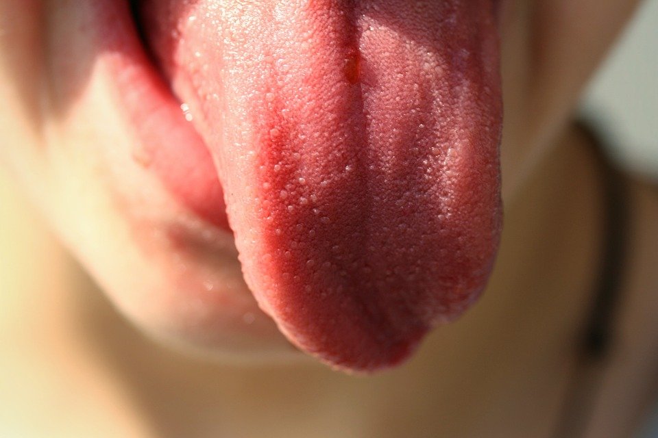 a child with a healthy tongue and no signs of thrush