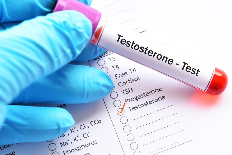 How Having Low Testosterone Levels Can Affect Your Health