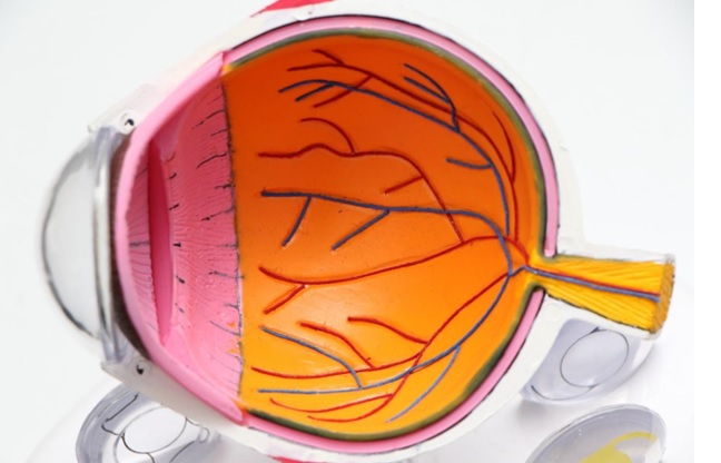 6 Tips for Optimal Cataract Surgery Recovery