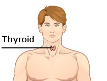 Safeguarding Your Health from an Overzealous Thyroid