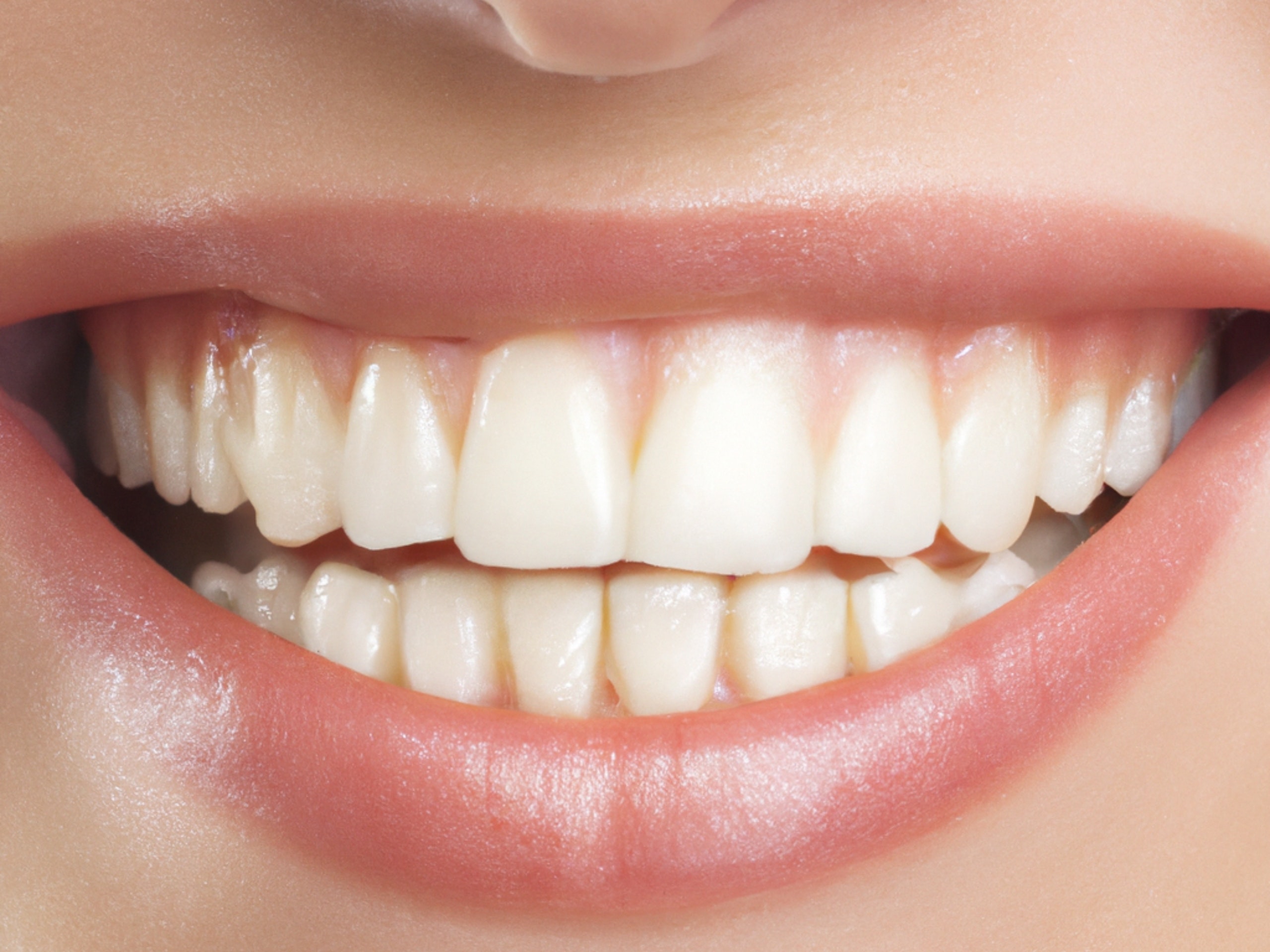 Beyond Teeth Masterful Dental Marketing for Lasting Impressions